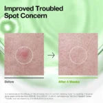 Anua Azelaic Acid 3 Cica Skin Clarifying Toner 250ml