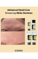 COSRX All About Snail Kit 4-steps